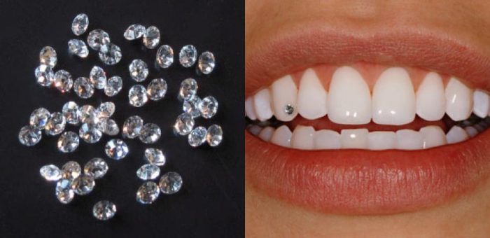 Cosmetic dental treatment